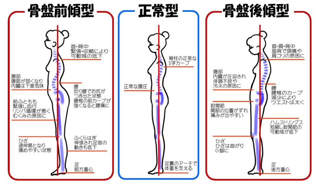 姿勢の良い見本と悪い見本