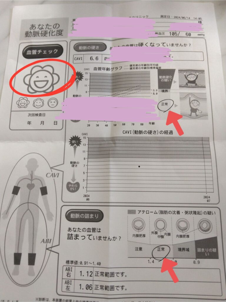 動脈硬化（CAVI、ABI）の検査結果