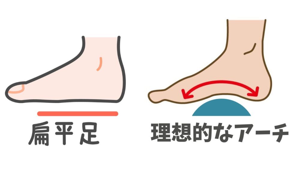 偏平足と理想的なアーチ