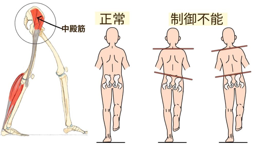 歩行における中殿筋の働き